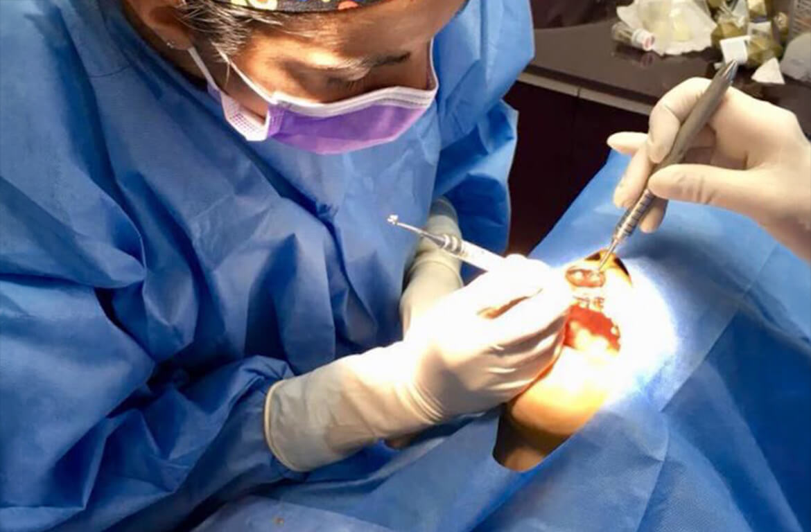 Chirurgie orale Chirurgie orale